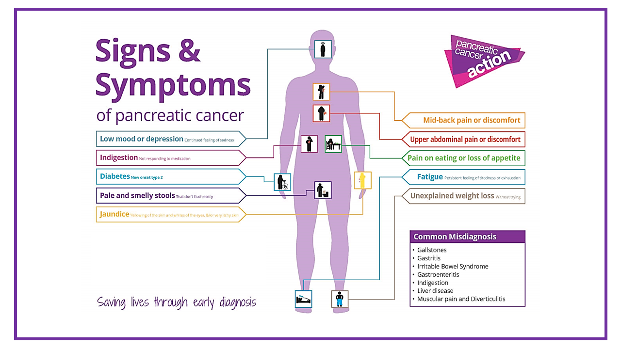 Pancreatic Cancer Symptoms, Signs of Pancreatic Cancer