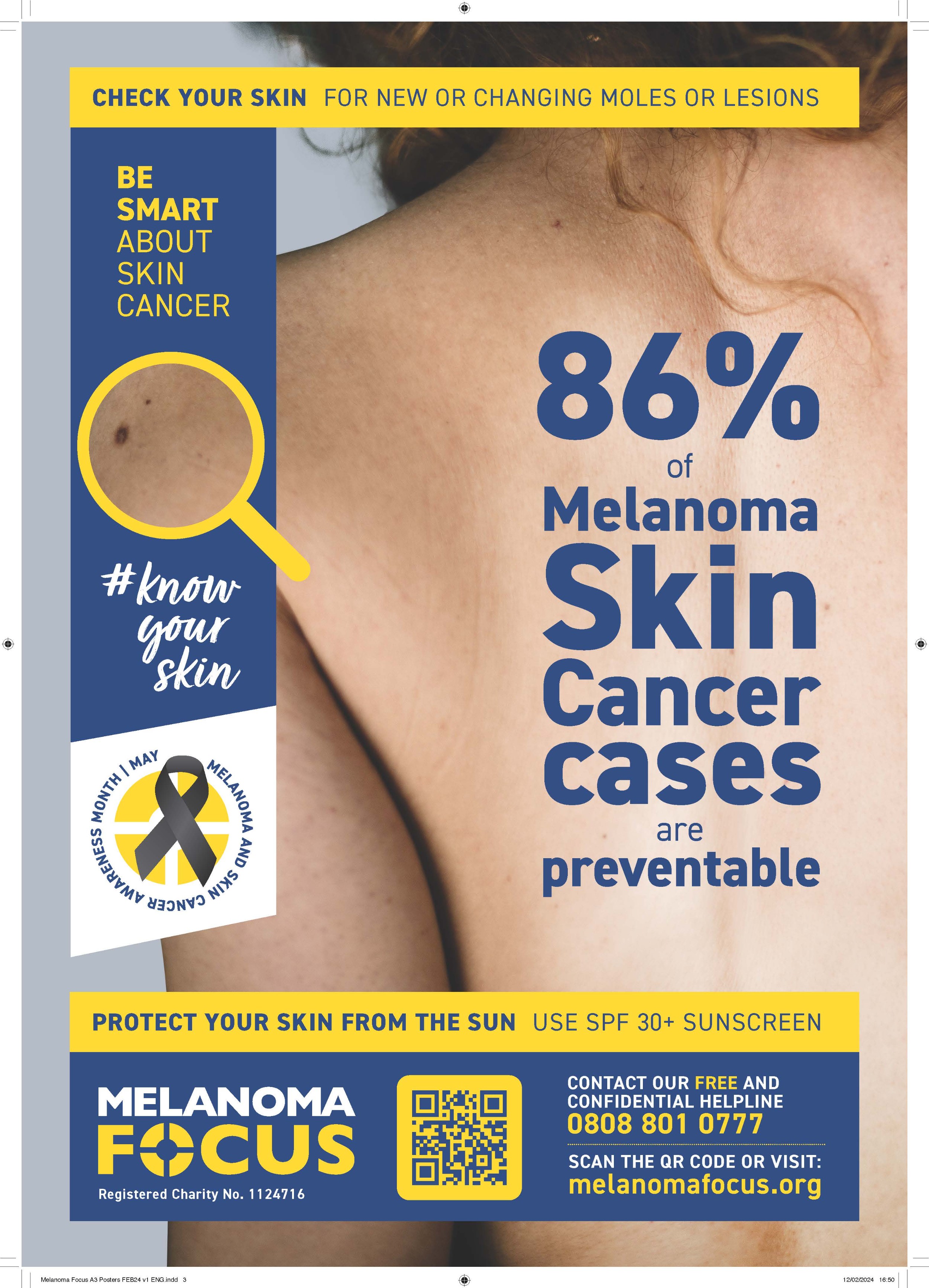 Pages from Melanoma-Focus-A3-Posters-FEB24-v1-ENG.pdf.jpg